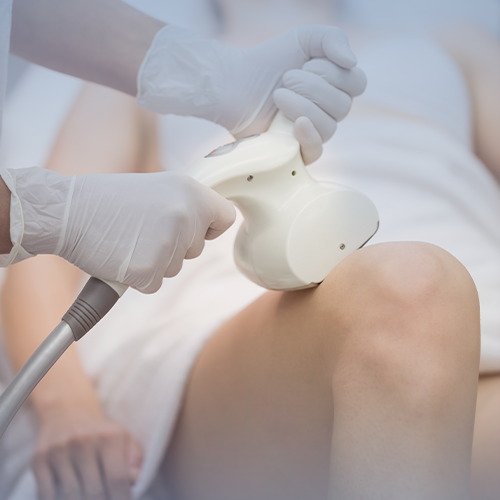 ليزر الفخذ كامل للنساء-الرياض