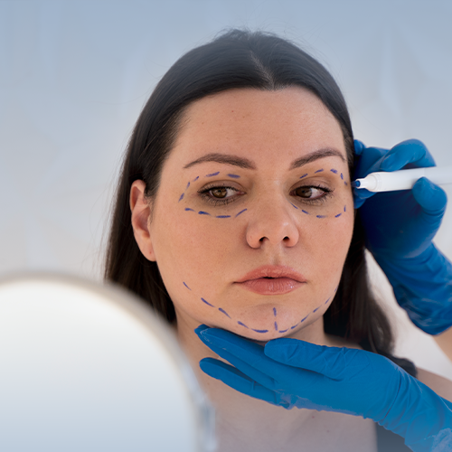 1 مل فيلر جوفيديرم -الرياض