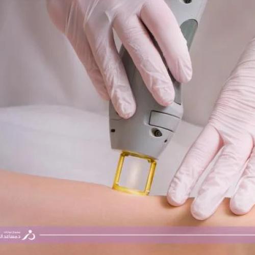 نصف رقبة الرجال