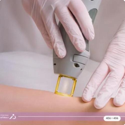 ازالة شعر خط السرة للرجال