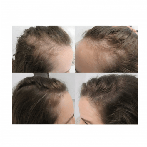 لاف مي نيو هير لنمو الشعر من الجذور 120 مل + ديرما...