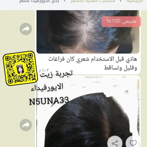 بكج الآيورفيدا لشعر+ سيروم هدية