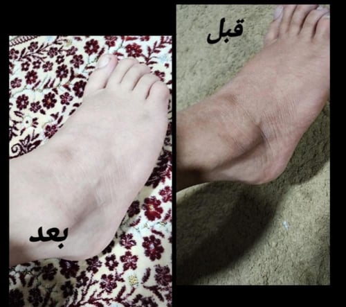 كريم وآيت بلس لتفتيح مضاعف وترطيب+ عبوه ثالثه هديه