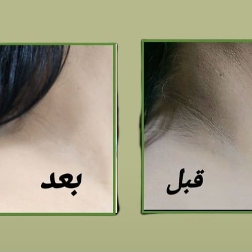 بكج تفتيح البشرة - كريم وصابونية وايت بلس للوجه وا...