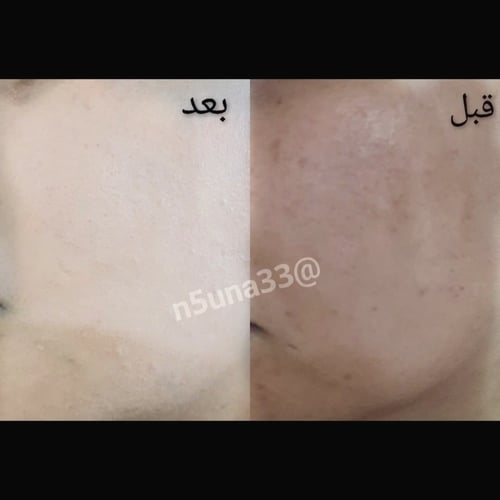 بكج تفتيح البشرة - كريم وصابونية وايت بلس للوجه وا...