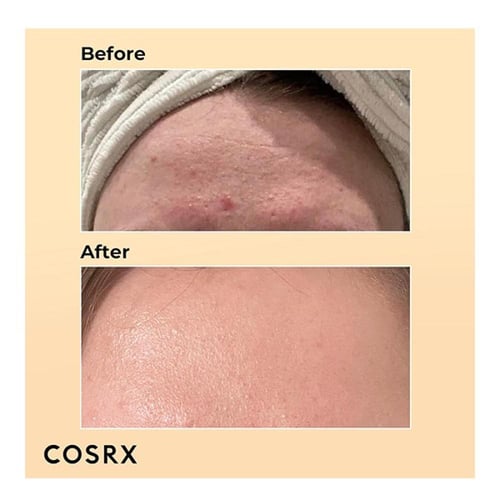 سيروم مستخلص موسين باور خلاصه قوه الحلزون من كوسرك...