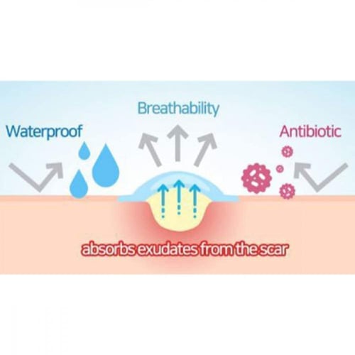 لصقات للوجه المعجزة 30 يوما لعلاج الحبوب والآثار م...