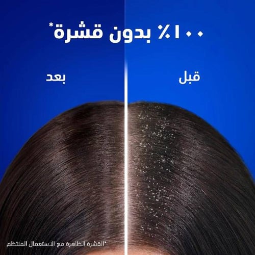 شامبو وبلسم الشعر النعناع المنعش 2في 1 من هيد اند...