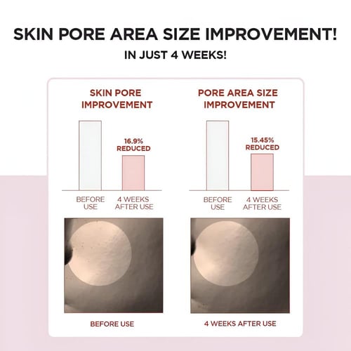 امبوله سيروم لتضيق المسام مدغشقر سينتيلا من سكين10...