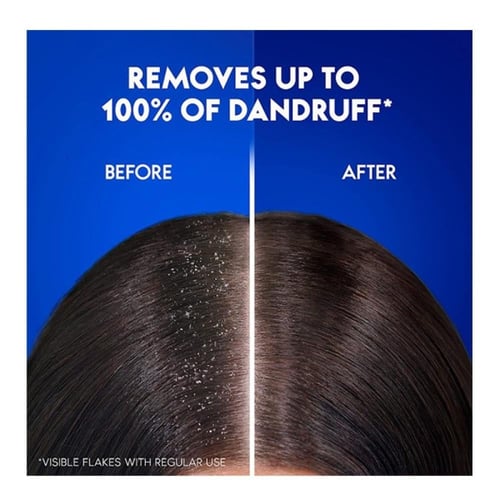 شامبو شعر نظافة واناقة ضد القشرة من هيد اند شولدرز...