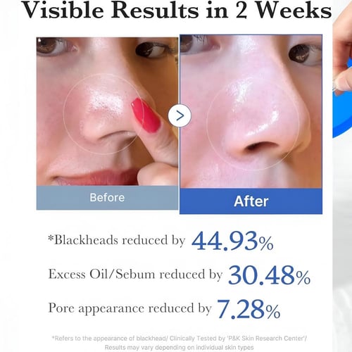 مسحات زيرو بور لتضيق المسام وتنظيف البشرة من ميديك...