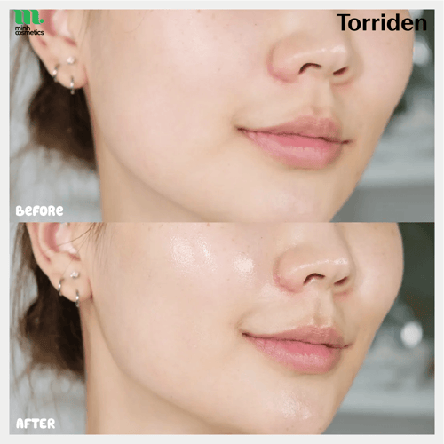 توريدين سيروم حمض الهيالورونيك لجميع أنواع البشرة...