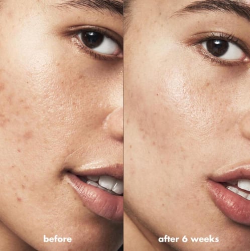 ايلف سيروم لتجديد البشرة بثلاثة احماض 4.2 مل حجم م...