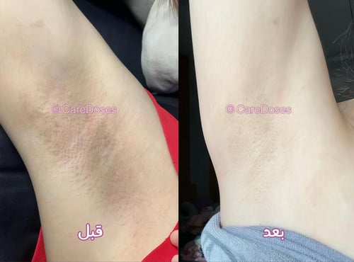 صابون شوكو بار الديتوكس اليومي من ساتيدا Choco Bar...