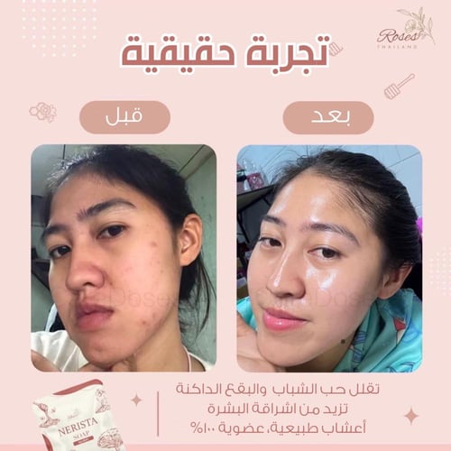 صابونة التفتيح للوجه من نيريستا - Nerista Face Soa...