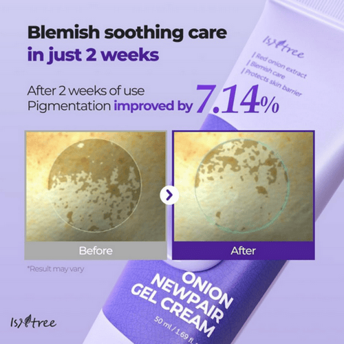 كريم جل نيوبير خلاصة البصل من ازنتري - 50 مل