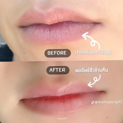 جل سيروم ليب بيرفيكتور