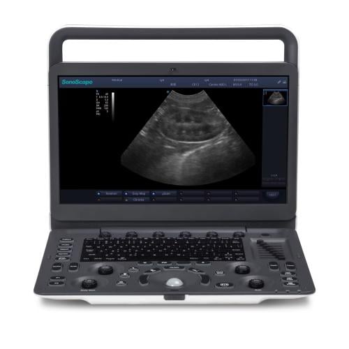 SonoScape E1 ultrasound device for diagnostic imag...