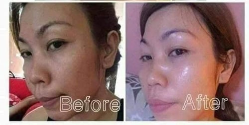 dr alvin rejuvinating original anti pimples anti m...