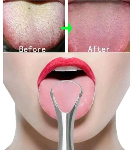 منظف اللسان