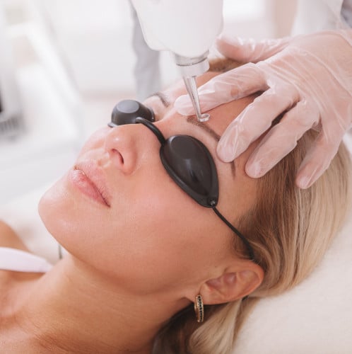 جلستين ليزر لتشقير الوجه