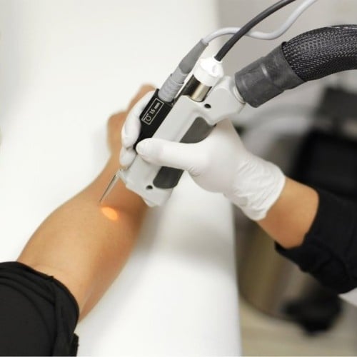 3 جلسات ليزر لمنطقة من اختيارك بجهاز إيليت بلس مع...