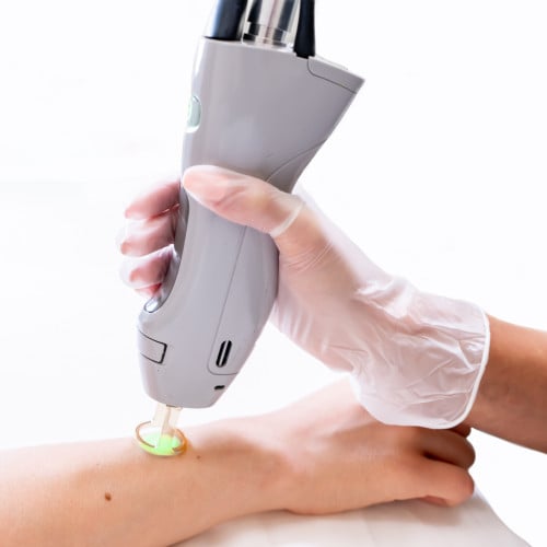 جلستين ليزر جسم كامل للشعر السميك فقط بجهاز جنتل