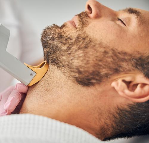 3 جلسات ليزر لتحديد الذقن للرجال مع الرتوش بجهاز ج...