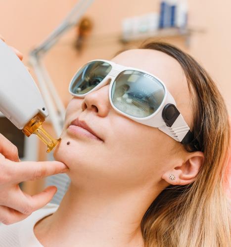 جلسة ليزر بجهاز سبكترا لتشقير الحواجب