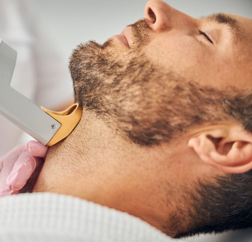 جلسة ليزر لتحديد الذقن للرجال مع الرتوش بجهاز جنتل...