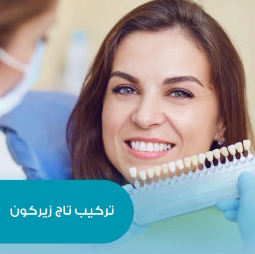 تركيب تاج زيركون