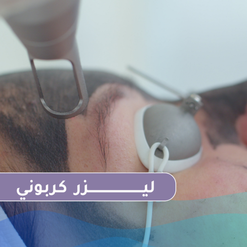 3 جلسات ليزر كربوني لمنطقة الوجه