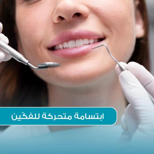 باقة التدخين: تنظيف أسنان + تبييض + توريد لثة + خط...