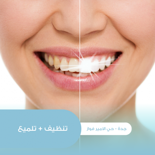 تنظيف أسنان عميق إزالة جير + تلميع