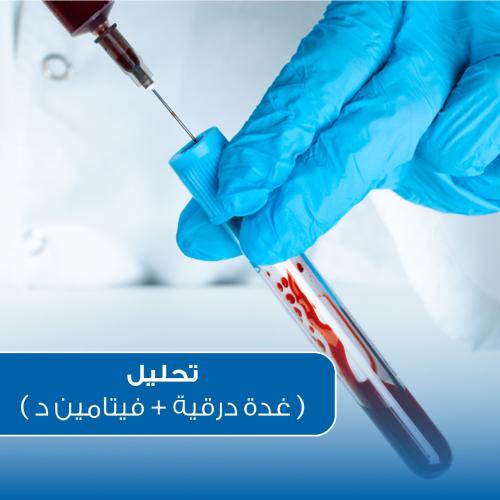 تحليل ( الغدة الدرقية + فيتامين د )