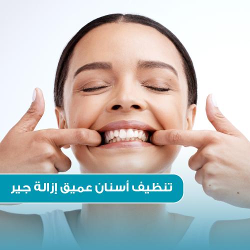 تنظيف أسنان عميق ( إزالة جير + تلميع )
