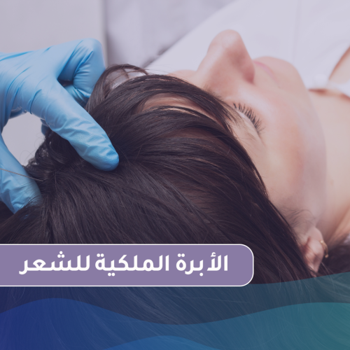 الأبرة الملكية للشعر