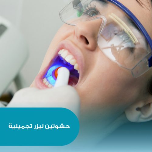 حشوتين تجميلية (ليزر)