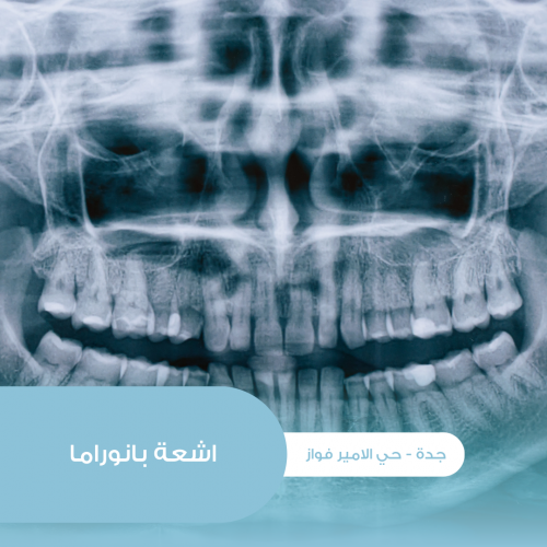 أشعة بانوراما