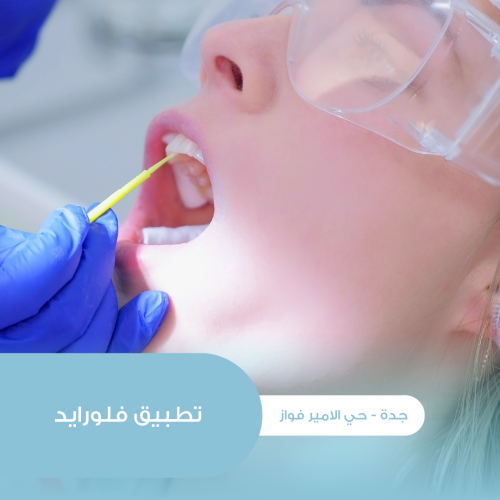 تطبيق فلورايد