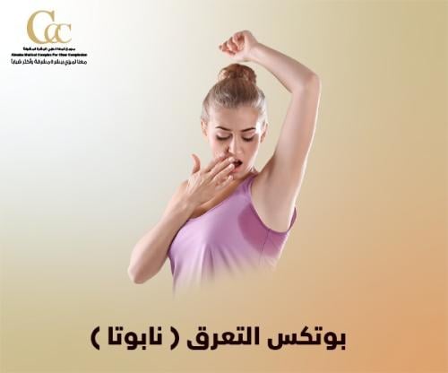 بوتكس التعرق (نابوتا)