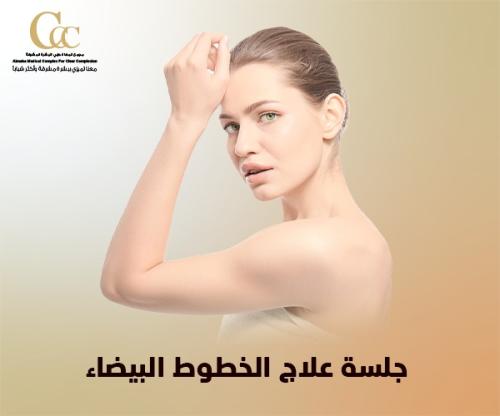 جلسة علاج الخطوط البيضاء