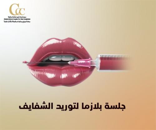 جلسة بلازما لتوريد الشفايف