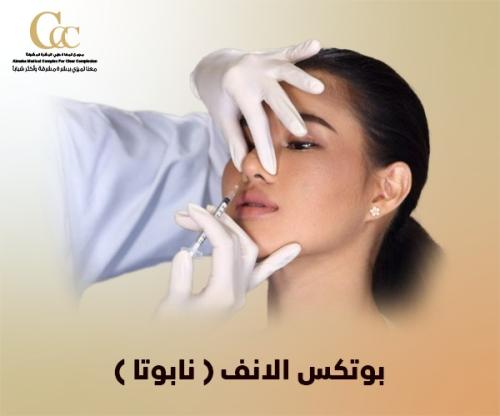 بوتكس الأنف (نابوتا)
