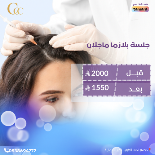 جلسة بلازما ماجلان