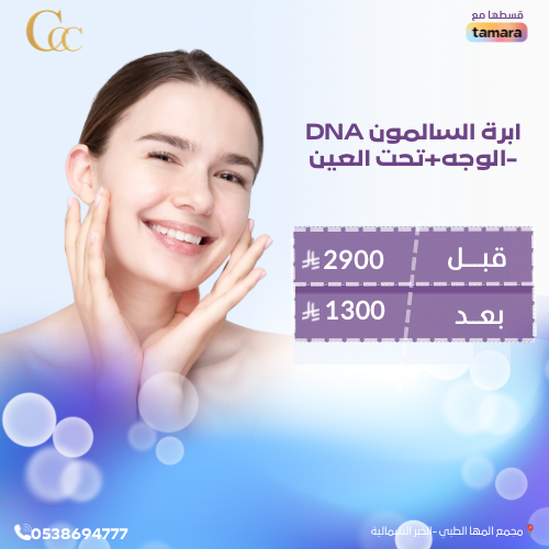 ابرة السالمونDNA-الوجه +تحت العين