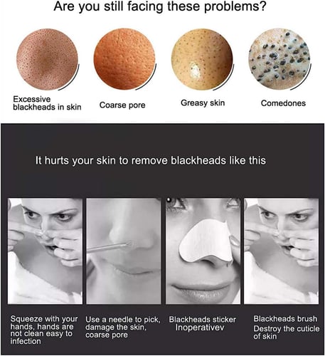 جهاز إزالة الرؤوس السوداء 5 في 1 H 301