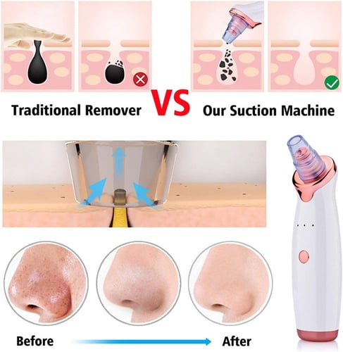 جهاز إزالة الرؤوس السوداء 5 في 1 H 301