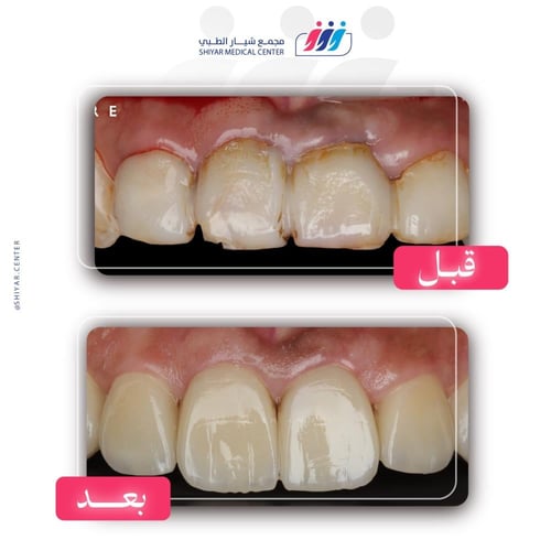 استشارة د. سالم عوني