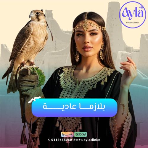 بلازما عادية